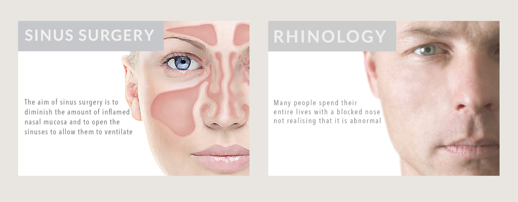 Brandon Hitchcock Rhinology General ENT Sinus Surgery