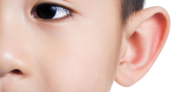 Otoplasty - prominent ear surgery