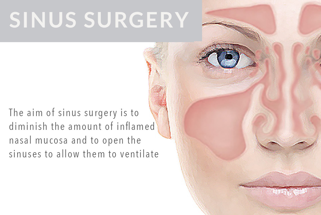 Brandon Hitchcock ENT Otoplasty plastic surgeon Tauranga