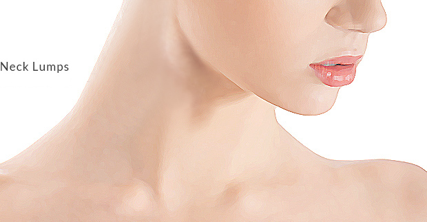 Neck Lumps surgery